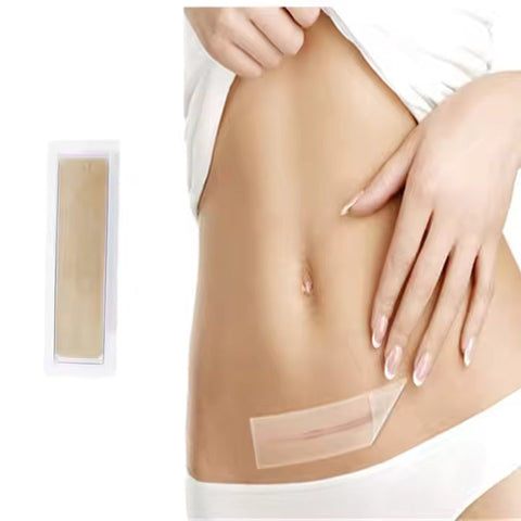 Online Products Health Care Products Silicone Scar Tape New Product Mark Patch Scar Removal Silicone Scar Sheet